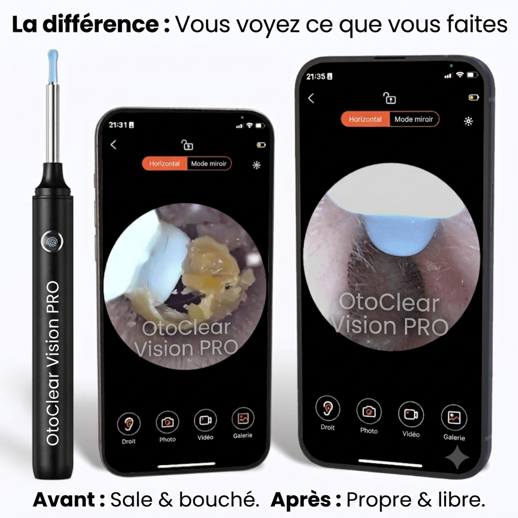 OtoClear Vision — Nettoyeur auditif intelligent 360°