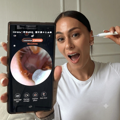 OtoClear Vision — Nettoyeur auditif intelligent 360°