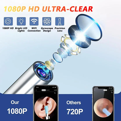 OtoClear Vision — Nettoyeur auditif intelligent 360°
